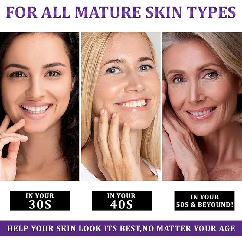 Crema schiarente per macchie Niacinamide Riduce cloasma Melasma Melanina Dissolvenza Linee sottili Dissolvenza Macchia scura Opaco Idratante Cura del viso