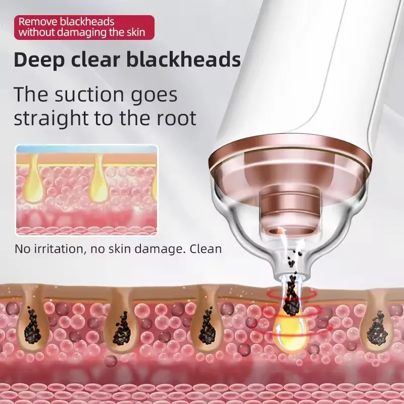 Elettrico visivo per la rimozione dei punti neri Aspirapolvere per i pori Strumento per l'estrazione dei brufoli dell'acne del viso con fotocamera 6 teste di aspirazione Cura della pelle