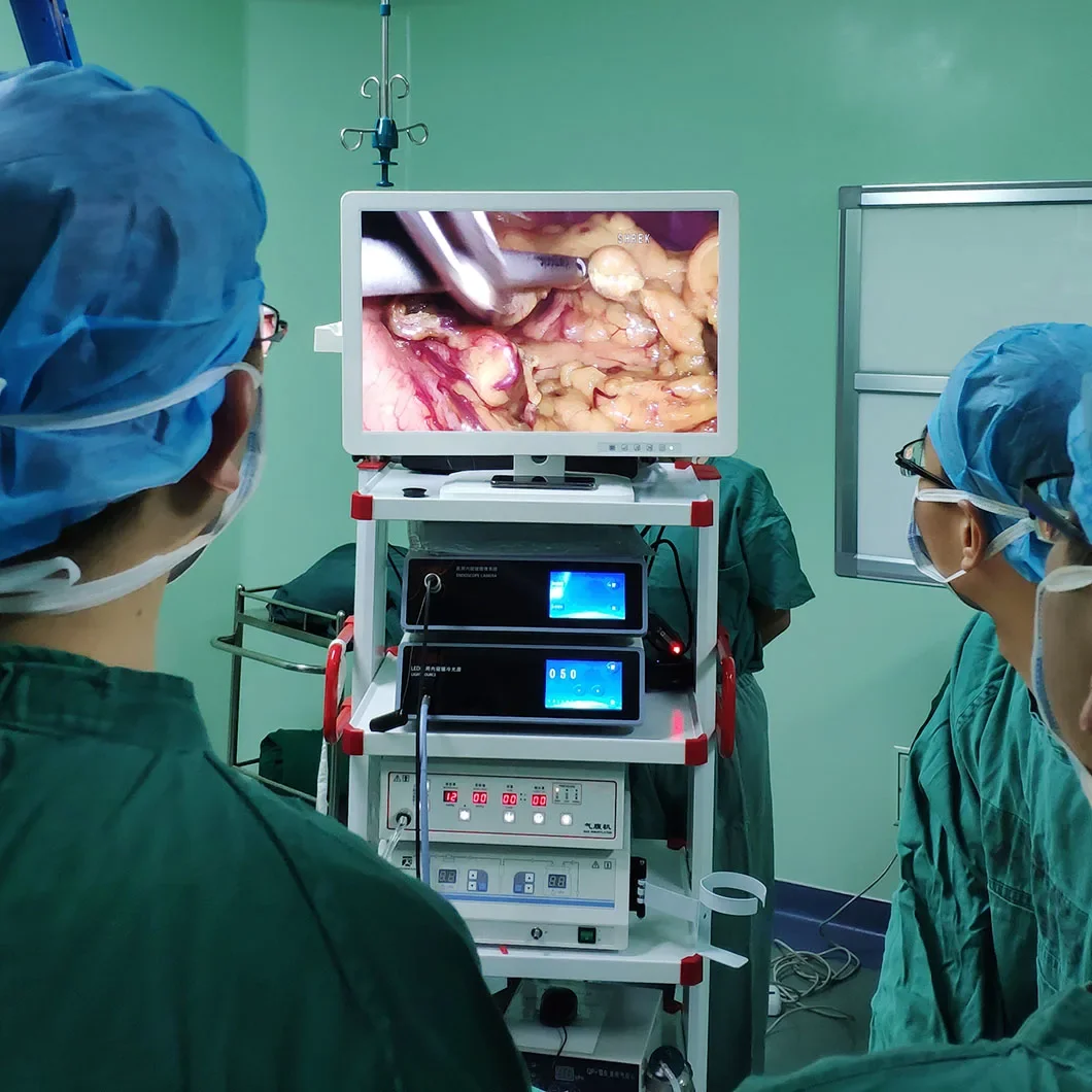 High Brightness 100W Hysteroscope LED Cold Light Source with Endoscope moni tor Price