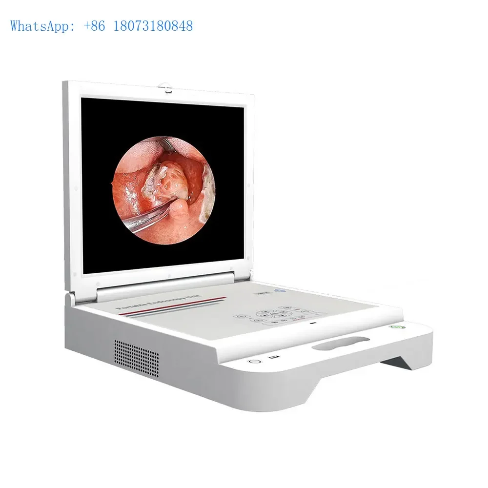 LTES44 Medical Clinic Portable CCD Digital 17 Inches Video Endoscope Camera LED Light Source