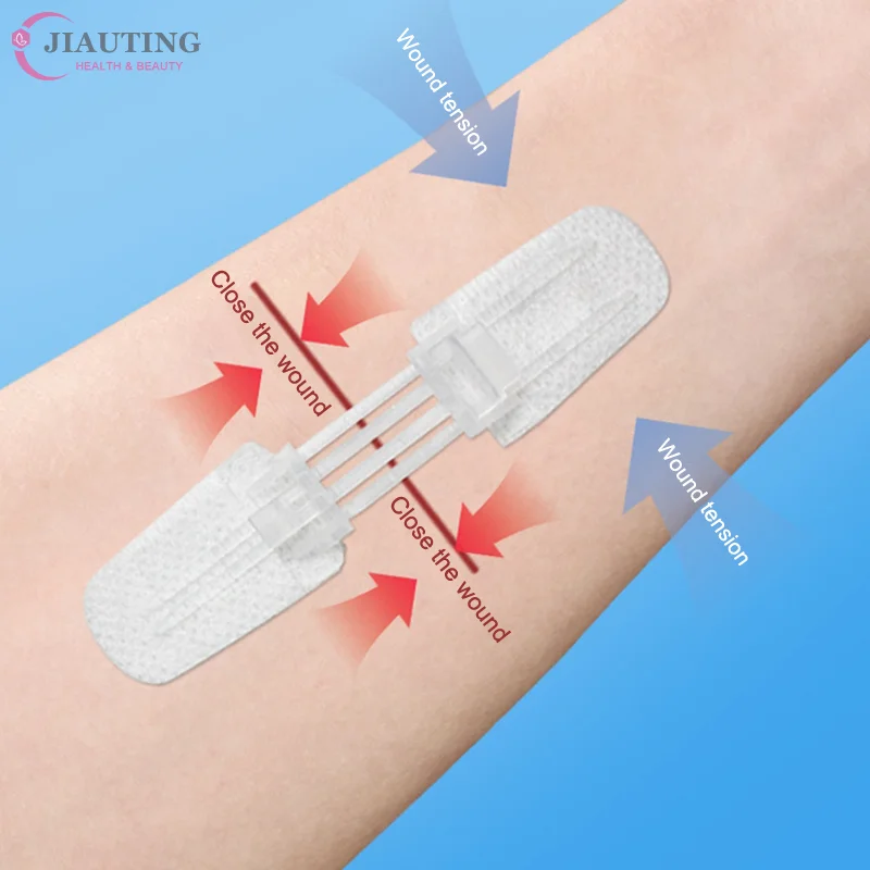 

1 шт. Пластырь-застежка на молнии для безболезненного закрытия ран, безшовный пластырь-повязка, уменьшающий натяжение ран, портативный, для использования на улице