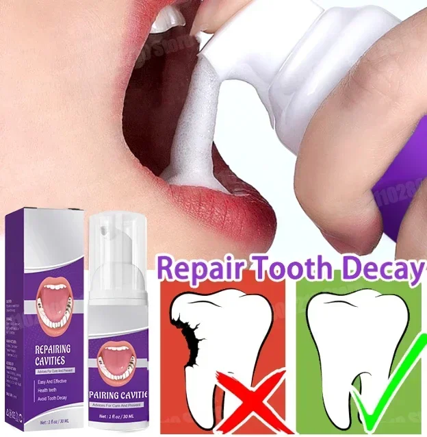 🍎fashion Teeth Whitening Toothpaste Removing Dental Calculus Protect Teeth Freshens Breath Anti-cavity Tooth New