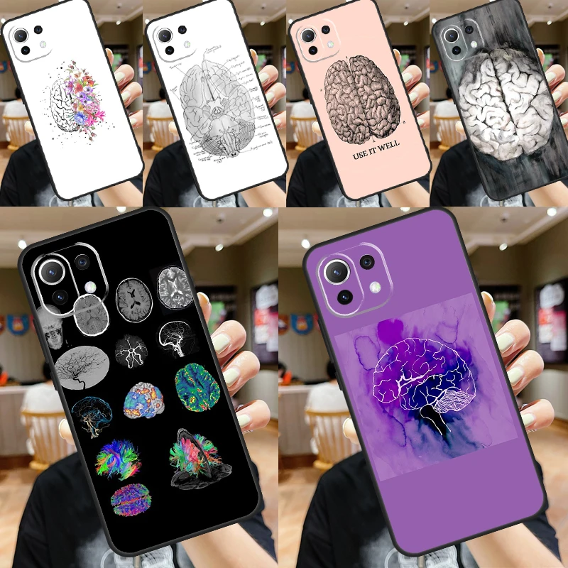 Anatomy Brain Case For POCO X3 X5 X6 F6 Pro M6 M5s F3 F5 Xiaomi 13T Pro 11T 12T 12 Lite 13 14 Ultra Cover