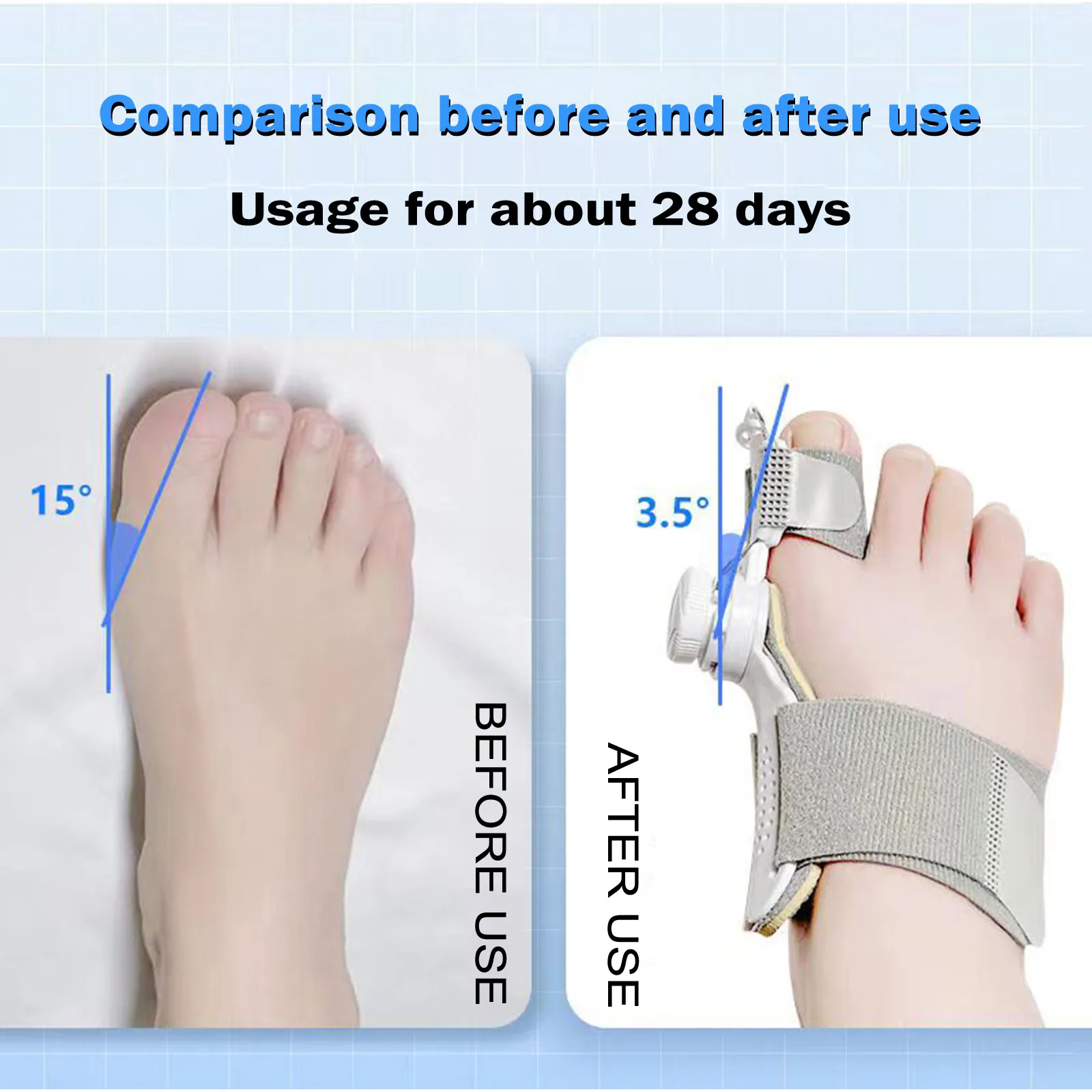 Knob-type Thumb Valgus Improvement And Correctionartifact Separated Toe Corrector Adult Unisex Orthopedic
