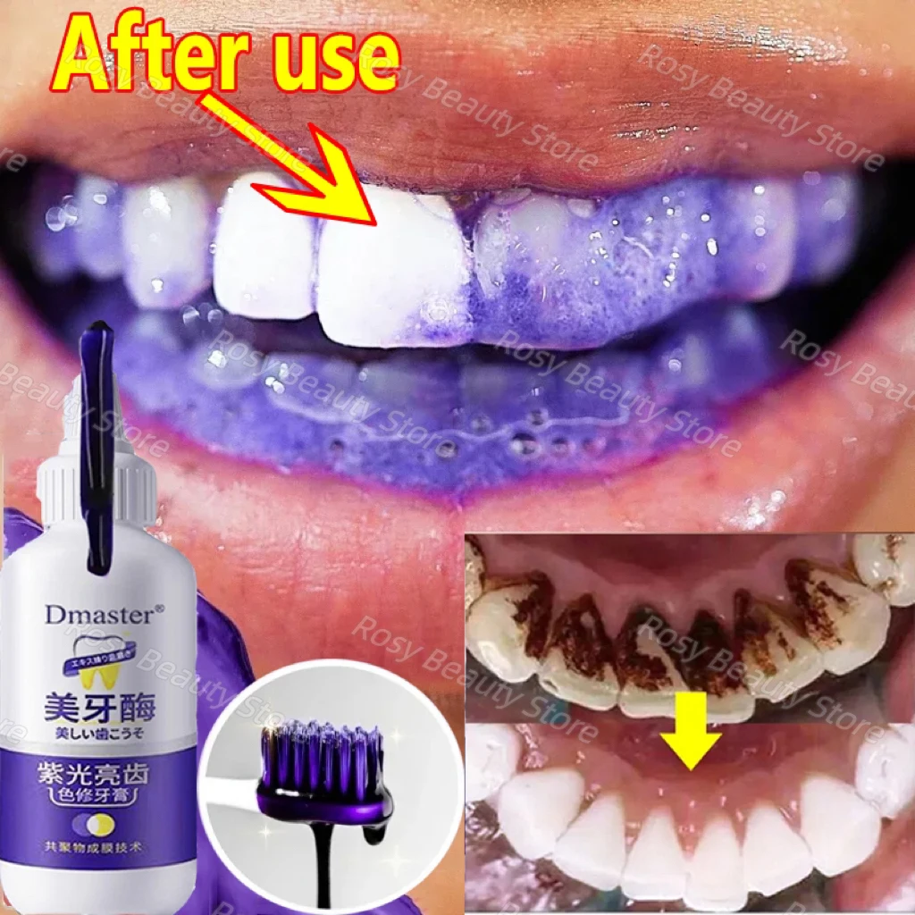 

V34 Purple Toothpaste Teeth Whitening Enzyme Remove Plaque Stains Oral Hygiene Cleaning Dental Tools Fresh Breath Beauty Health