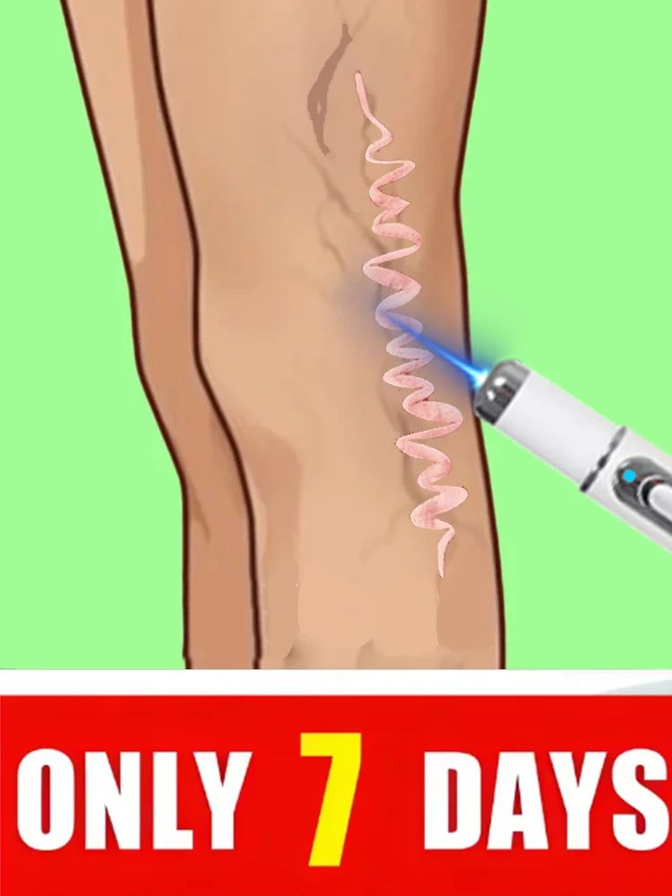 2025 Blue light pen and foot vein Tools to Help People with Limited Mobility