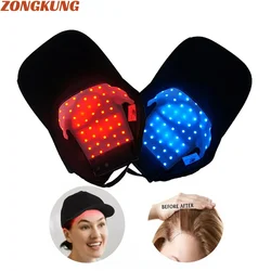 Gorro de terapia de luz roja para el crecimiento rápido del cabello, dispositivo de terapia de luz roja e infrarroja para el tratamiento de la caída del cabello con carga USB