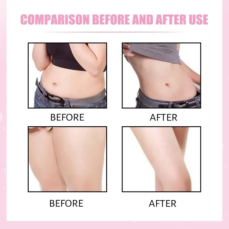 Slimming Fat Burning Cream Anti-cellulite Shaping Gel Moisturizing Loss Weight big belly Body Leg Waist scluping Firming Massage