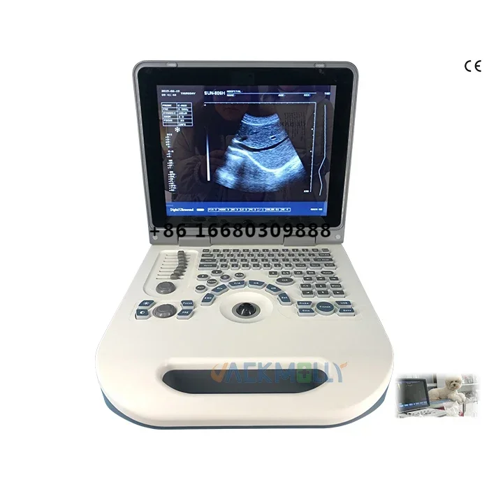 JM-806G Medical Equipment 2D Ultrasound Machine for Diagnose Human