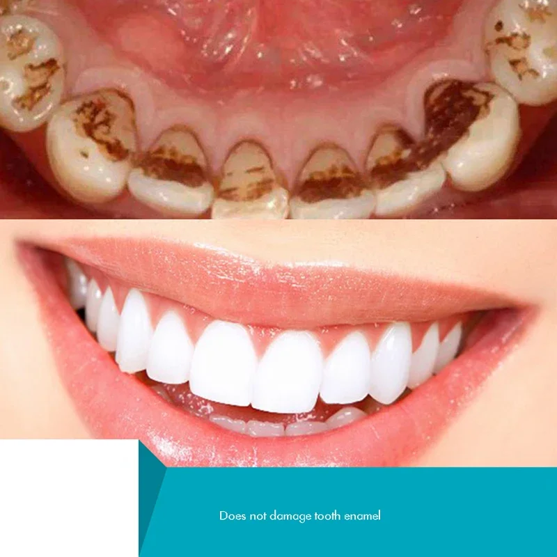 ハーブ歯粉末、天然歯美白パウダー、歯ステインリムーバー歯磨き粉粉末新鮮なミント、キシリトール