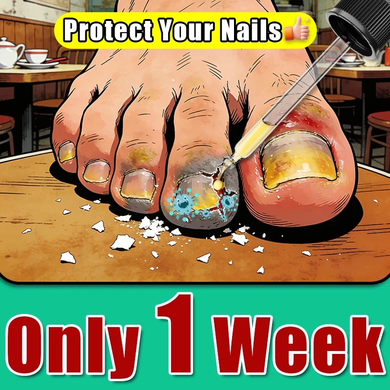 

Second Seneration Treatment Methods For OnyChomycosis, Toenail Thickening, And Paronychia