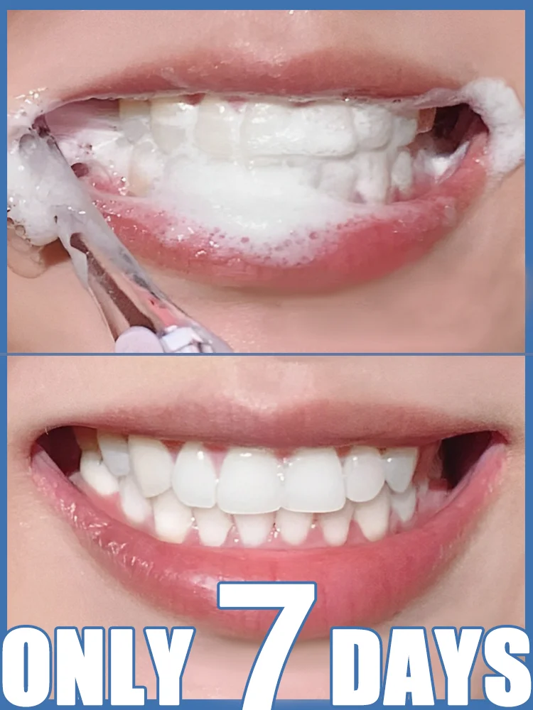

Brush away yellow teeth