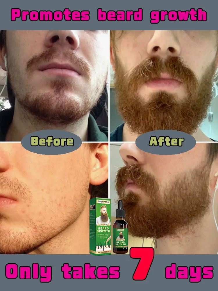 Essence de croissance de la barbe : stimulez une croissance rapide et robuste de la barbe