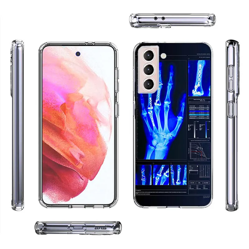 Autumu X ray Hand Bones Phone Case For Galaxy A15 A25 A35 A55 Samsung A10 A20E A30 A40 A50 A70 A11 A21S A31 A41 A51 A71 A9 A8 A7