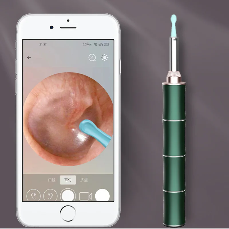 Smart Visual Otoscope 4.2mm WiFi Ear Spoon Ear Cleaning Endoscope Earwax Removal Tool Ear Spoon Kit