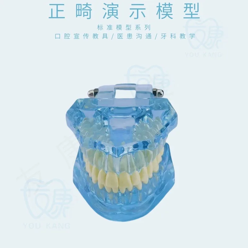 Oral model 6x dental caries compared to 4x classification times dental caries evolution
