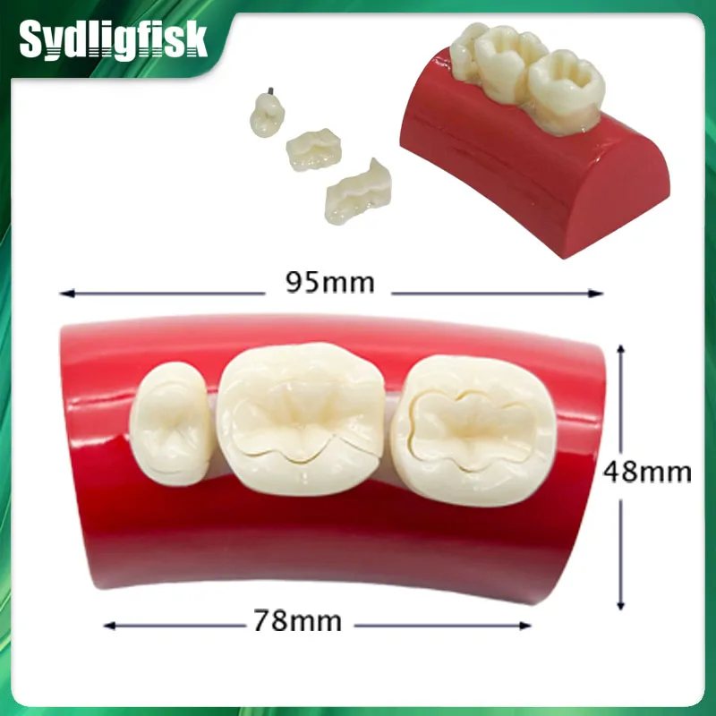New Dental Inlay Exercise Model Block Filling Exercise Typodont Model Resin Materials Oral Filling Model Dentist Teaching Study