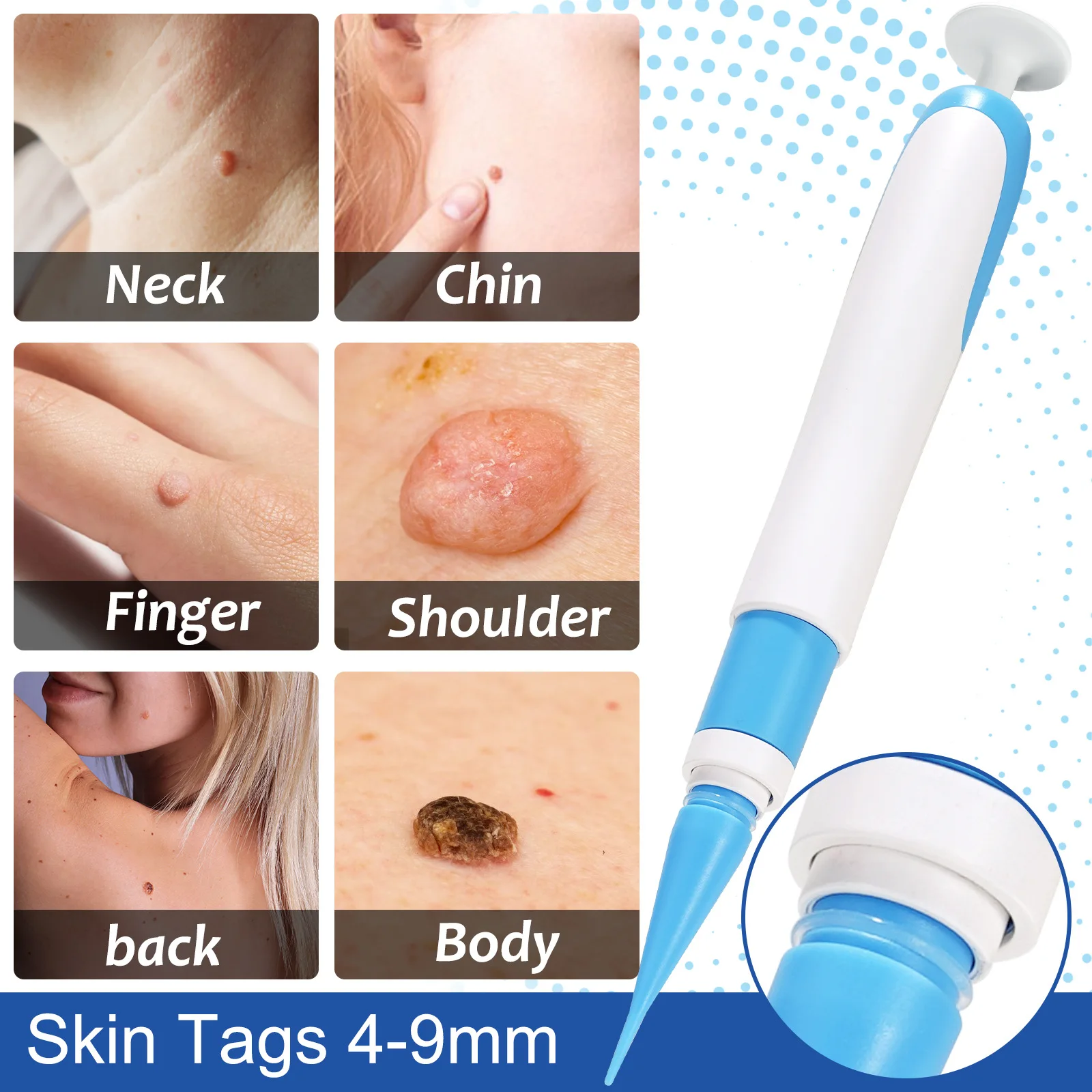 2 In1 Painless Auto Skin Tag Mole Wart Removal Kit Cleaning Tools Face Skin Care Body Wart Dot Treatments Remover Beauty Health