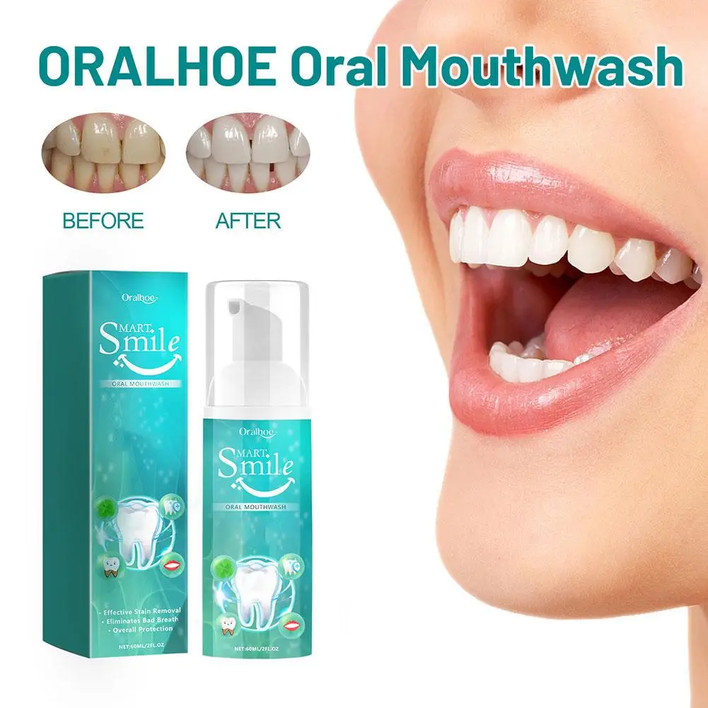 Teeth Cleansing Mousse Remove Plaque Stains Breath Whitening Hygiene Dental Toothpaste Foam Oral Caries Repair Freshen Ging Q0B9