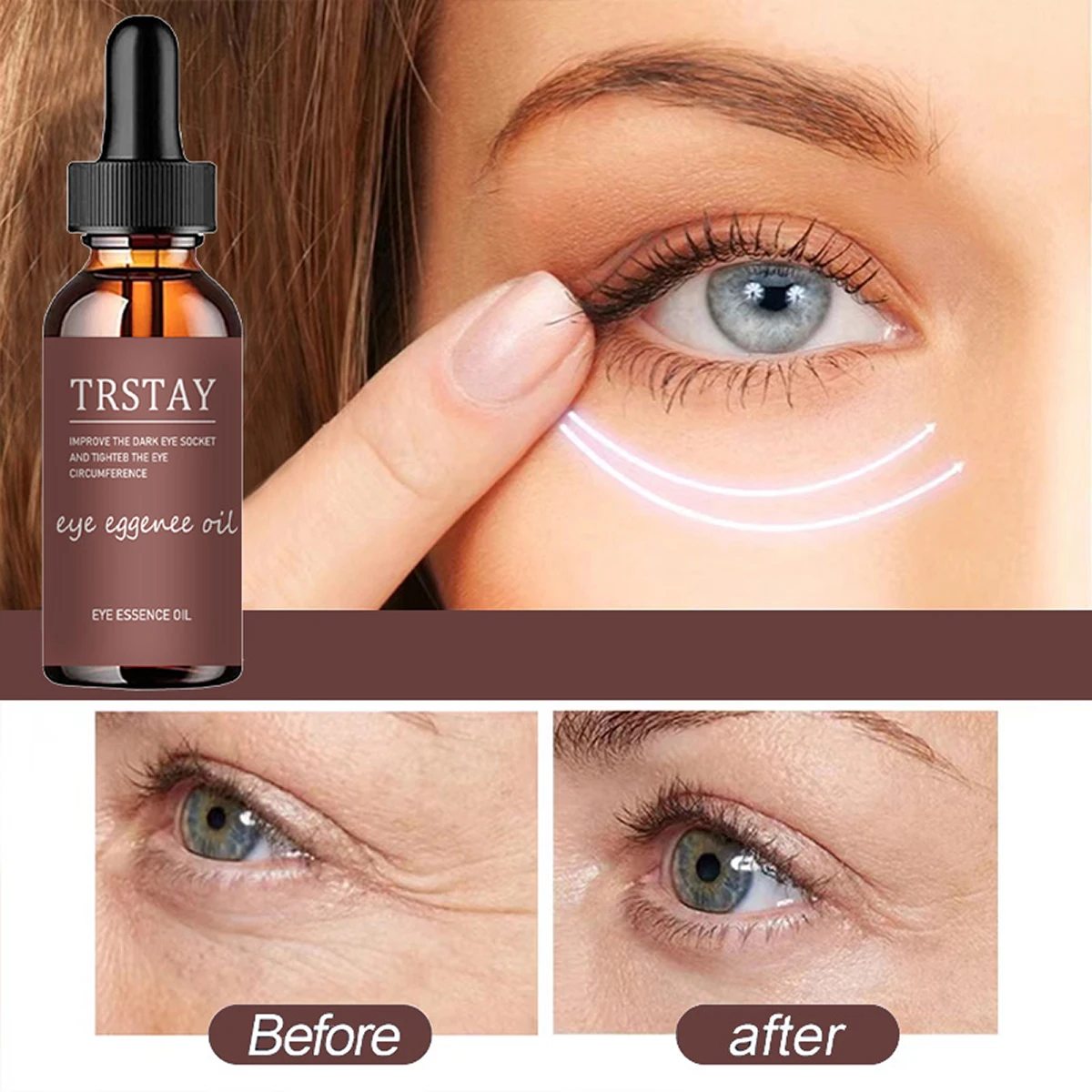 

TRSTAY essence oil for improving black eye socket and tightening eye circumference