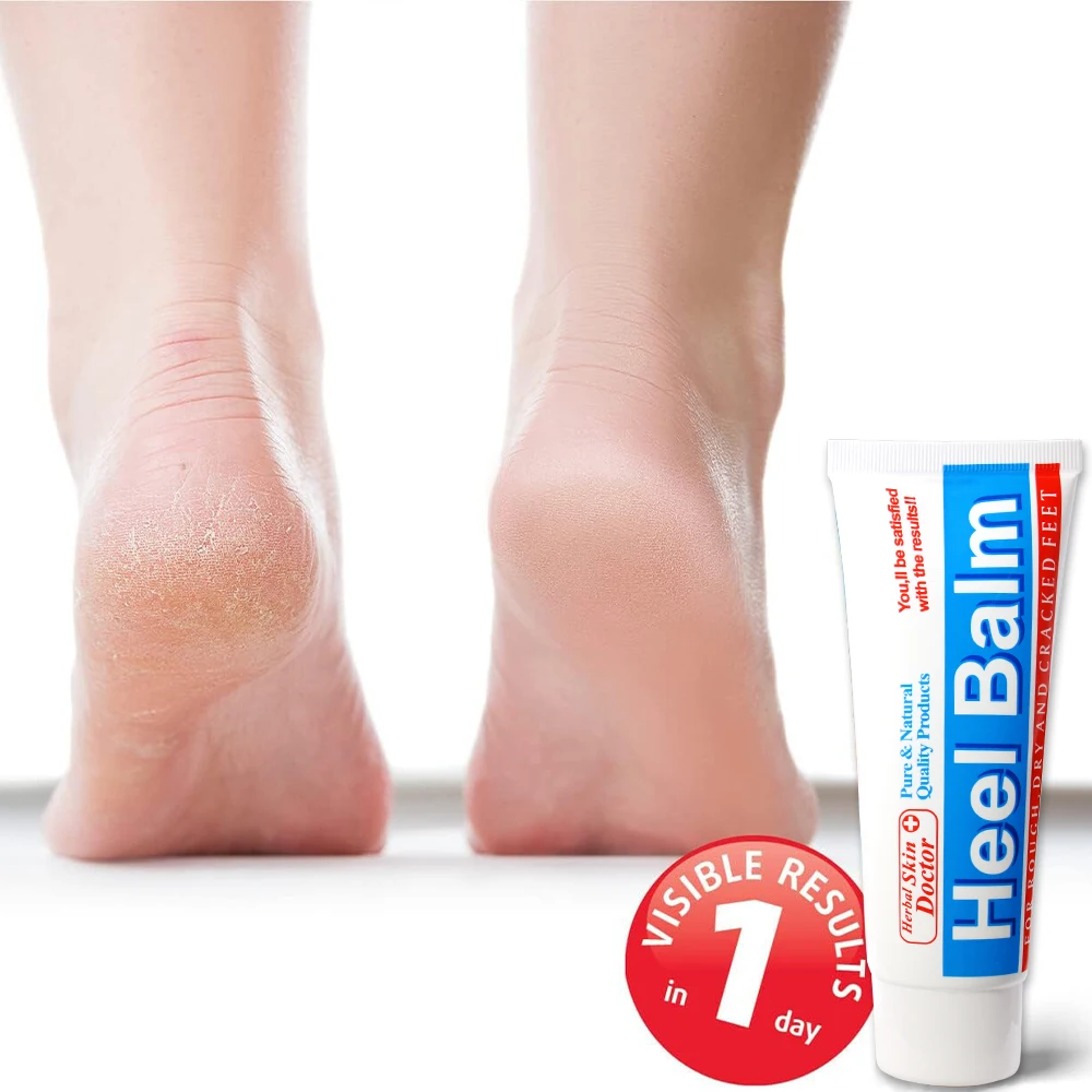 Herbal Frostbite Crack Foot Cream Oil Intensive Foot Repair Foot Cream Skin Healing Ointment for Cracked Heels Dry Feet