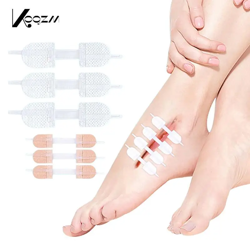 3Pc Rits Stropdas Wond Sluiting Patch Hemostatische Patch Wond Snelle Hechting Rits Pleister Outdoor Draagbare