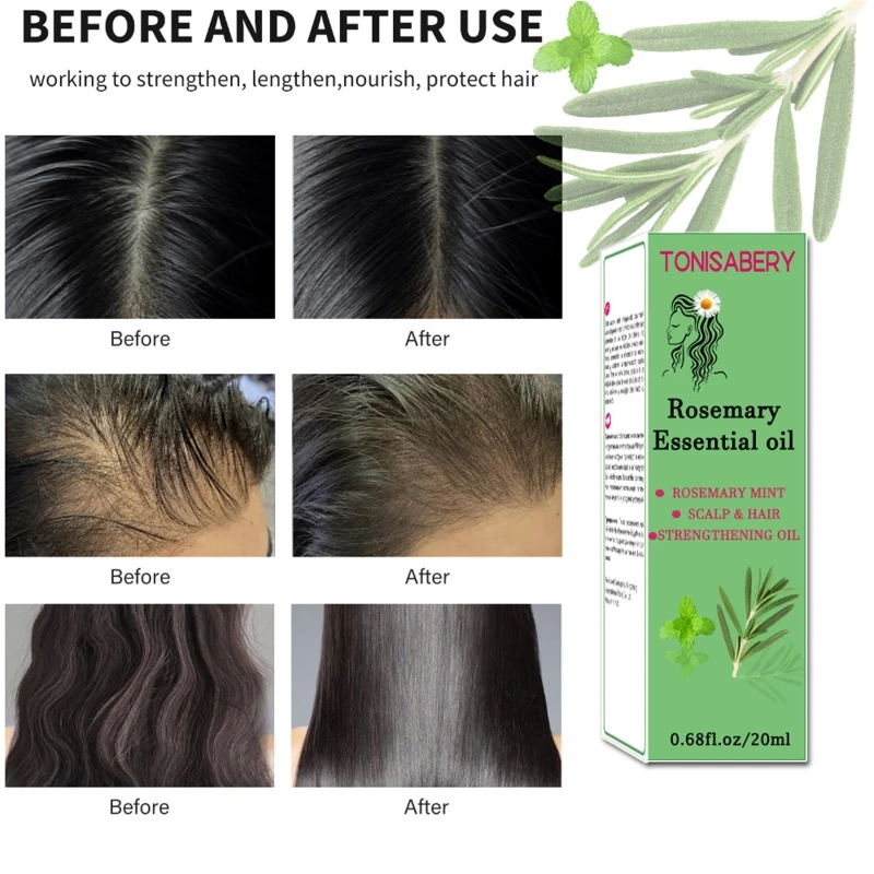 น้ำมันโรสแมรี่ Essential สำหรับการเจริญเติบโตของเส้นผม, ฟื้นฟูการสูญเสียเส้นผม, เสริมสร้างเส้นผม, บำรุงหนังศีรษะ, ปรับปรุงการไหลเวียน
