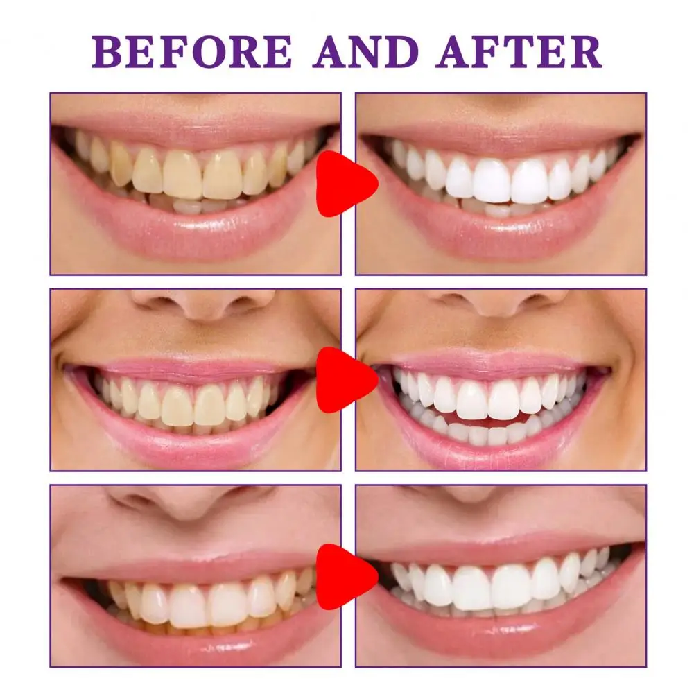 Útil roxo clareamento de limpeza oral creme dental dental oral suave branqueamento