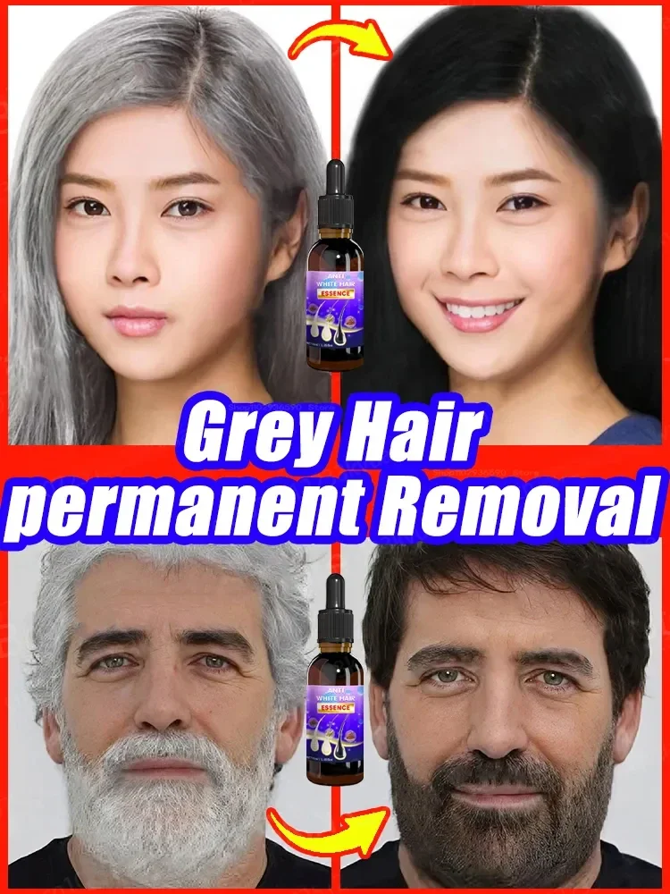 Anti grey Hair Serum treatment Remedy White oscuring Hair White To Black Natural Color Repair prodotti nutrienti per la cura dei capelli