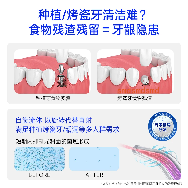Special flusher for porcelain teeth, dental floss to wash tooth dirt, wisdom tooth socket