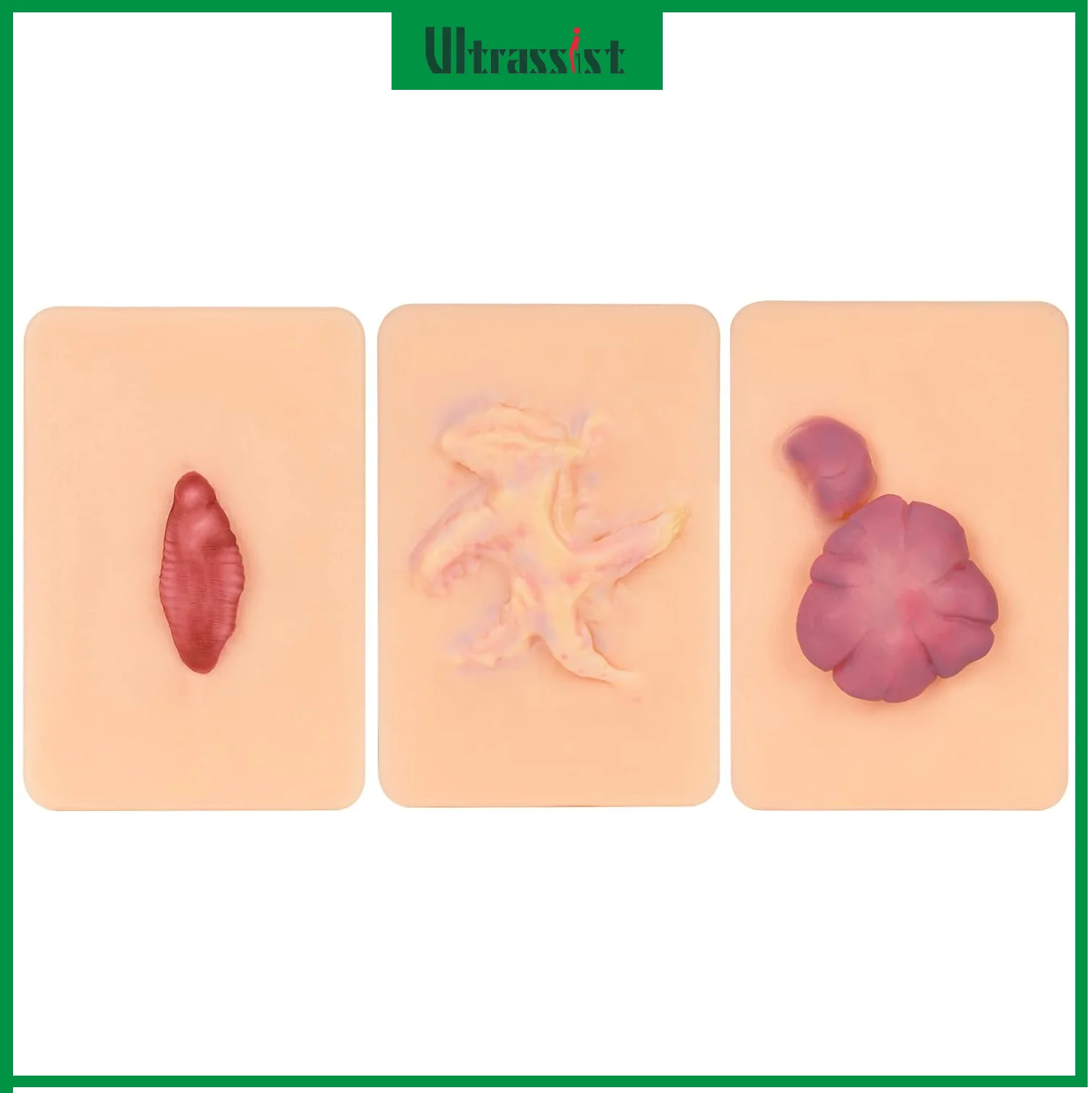 Ultrassist Scar Hyperplasia Wound Model Keloids Wound Care Packing Trainer Demonstrations Tool Silicone for Medical Education