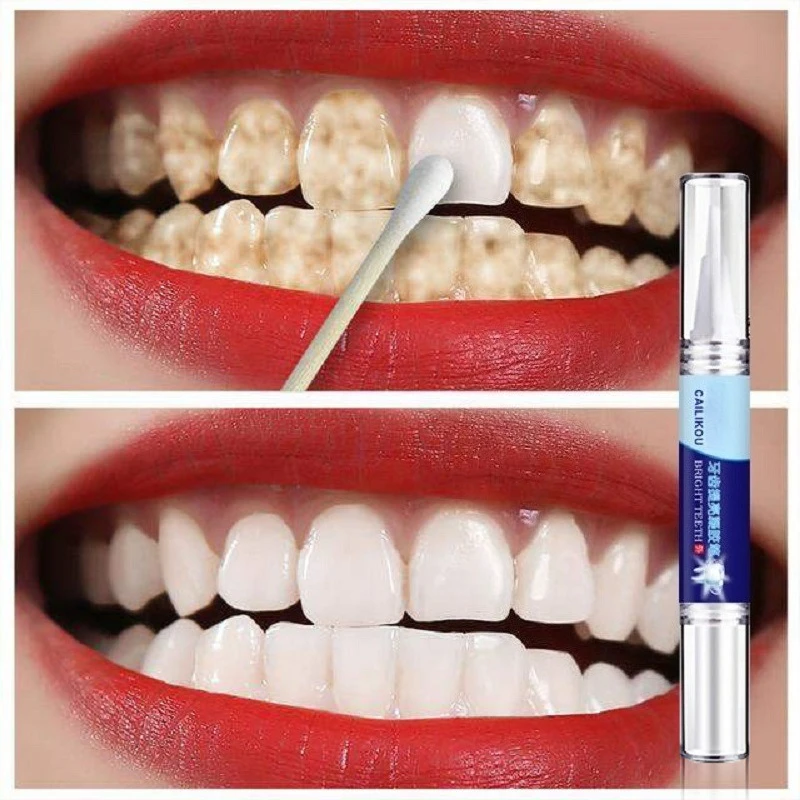 Teeth Whitening Stain Remover Brightening Gel Pen Effective Remove Plaque Stains Oral Teeth Care Pen Teeth Whitening Tools