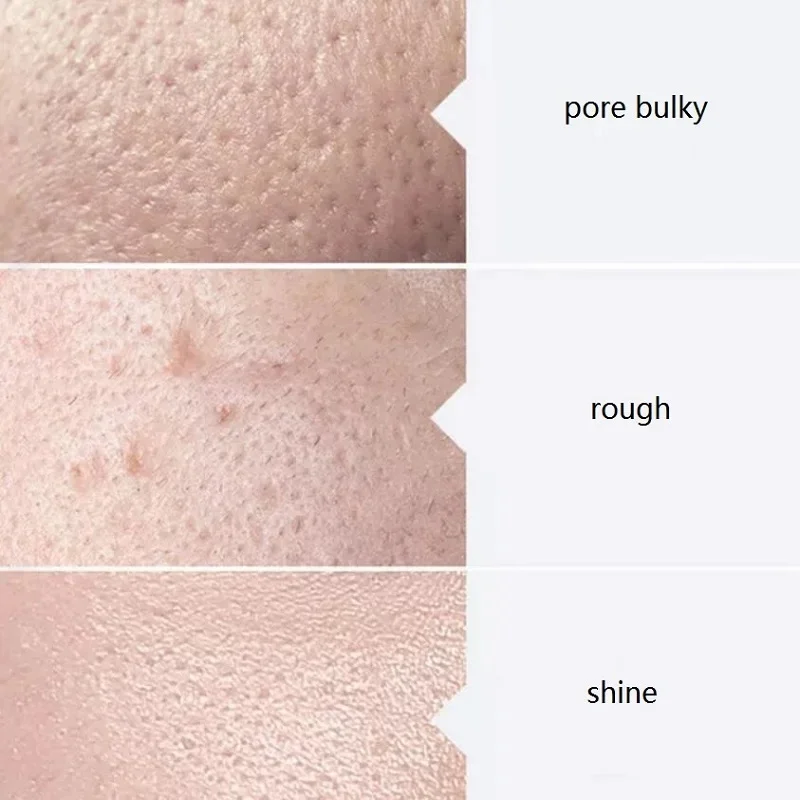 3 SZT. Mały Zestaw do Głębokiego Oczyszczania Pęcherzykami, Esencja do Twarzy w Butelce AS1 SA2 AO3, Maska do Twarzy na Bazie Wody, Odpowiednia do Salonów Kosmetycznych