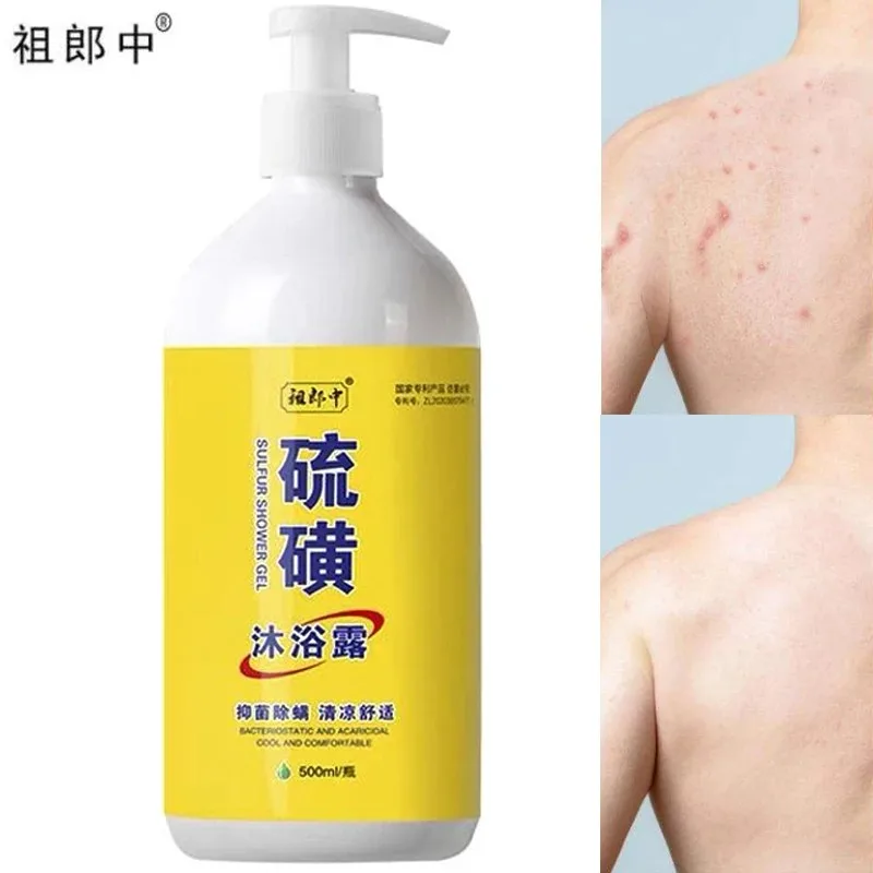 

New Super 500ml Sulfur Liquid Soap Removing Mites Bath Gel Deep Cleaning Mites Removal Shower Gel Body Cleaning Health Care