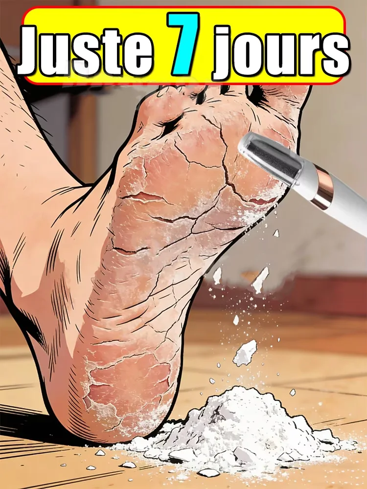

New electric foot scrub scab remover to remove dry and dead skin, professional foot therapy tool