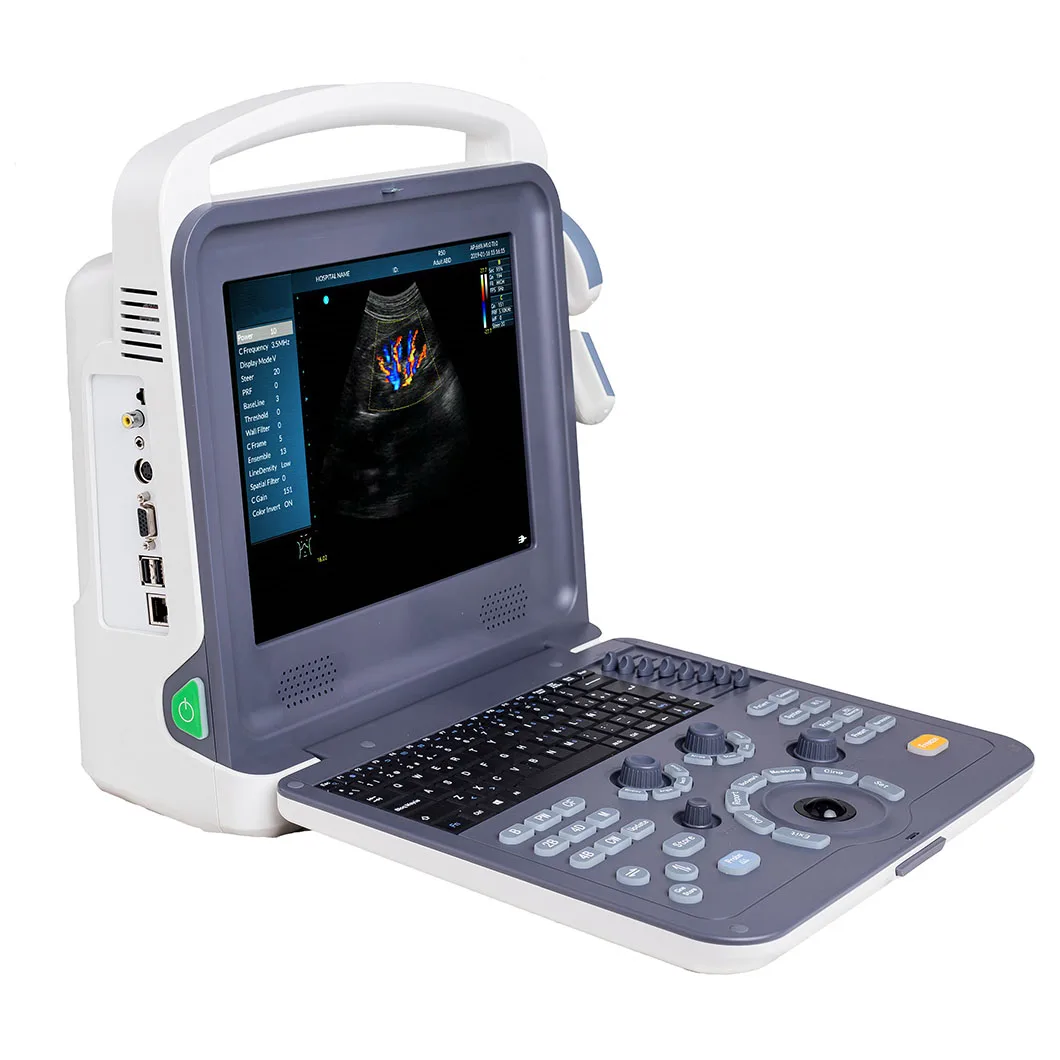 Medical Equipment Portable Real Time Color Doppler Ultrasound Scanner For Hospital Clinic