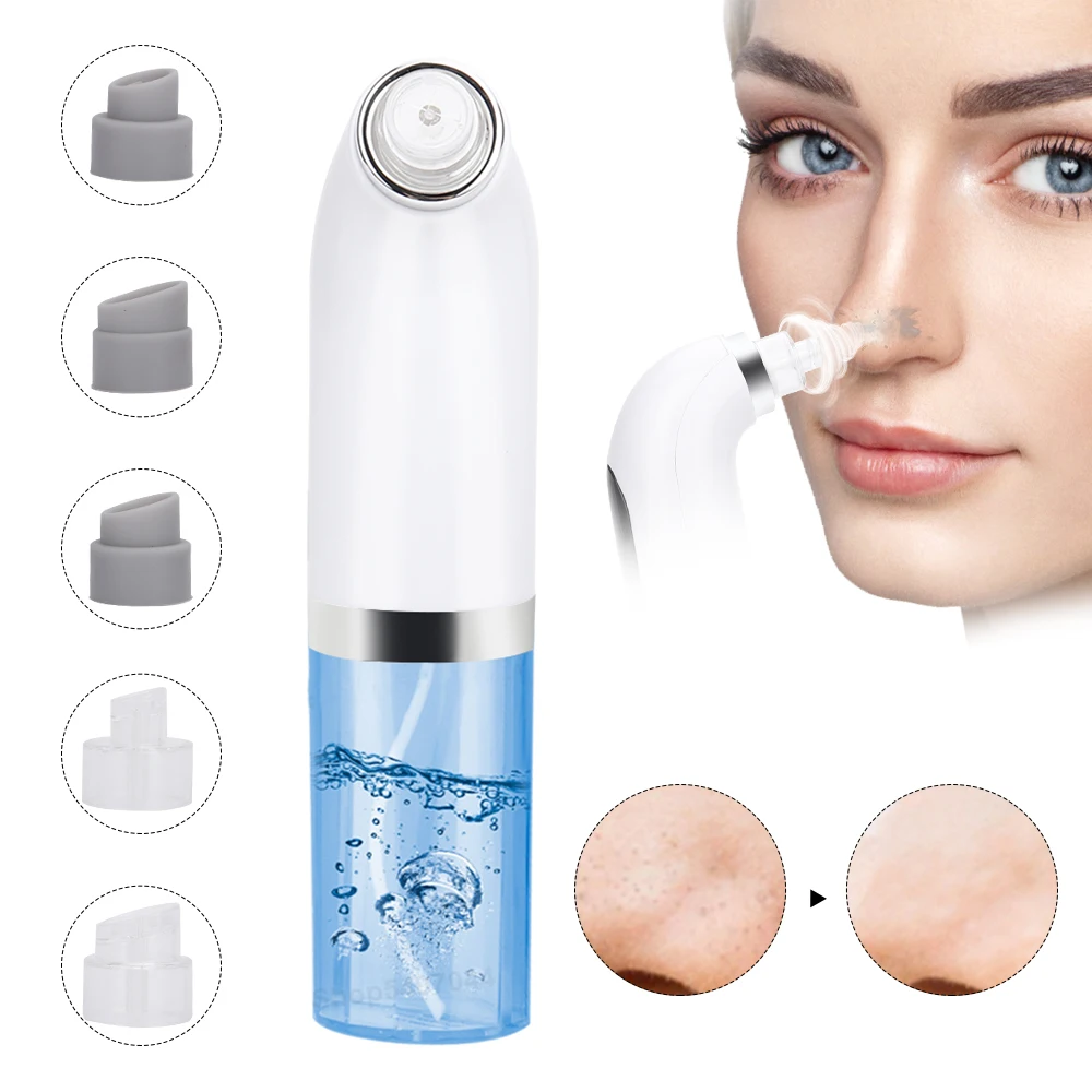 

Blackhead Remover Pore Vacuum Cleaner Upgraded Blackhead Vacuum Rechargeable Face Vacuum Comedone Extractor Tool for Blackhead