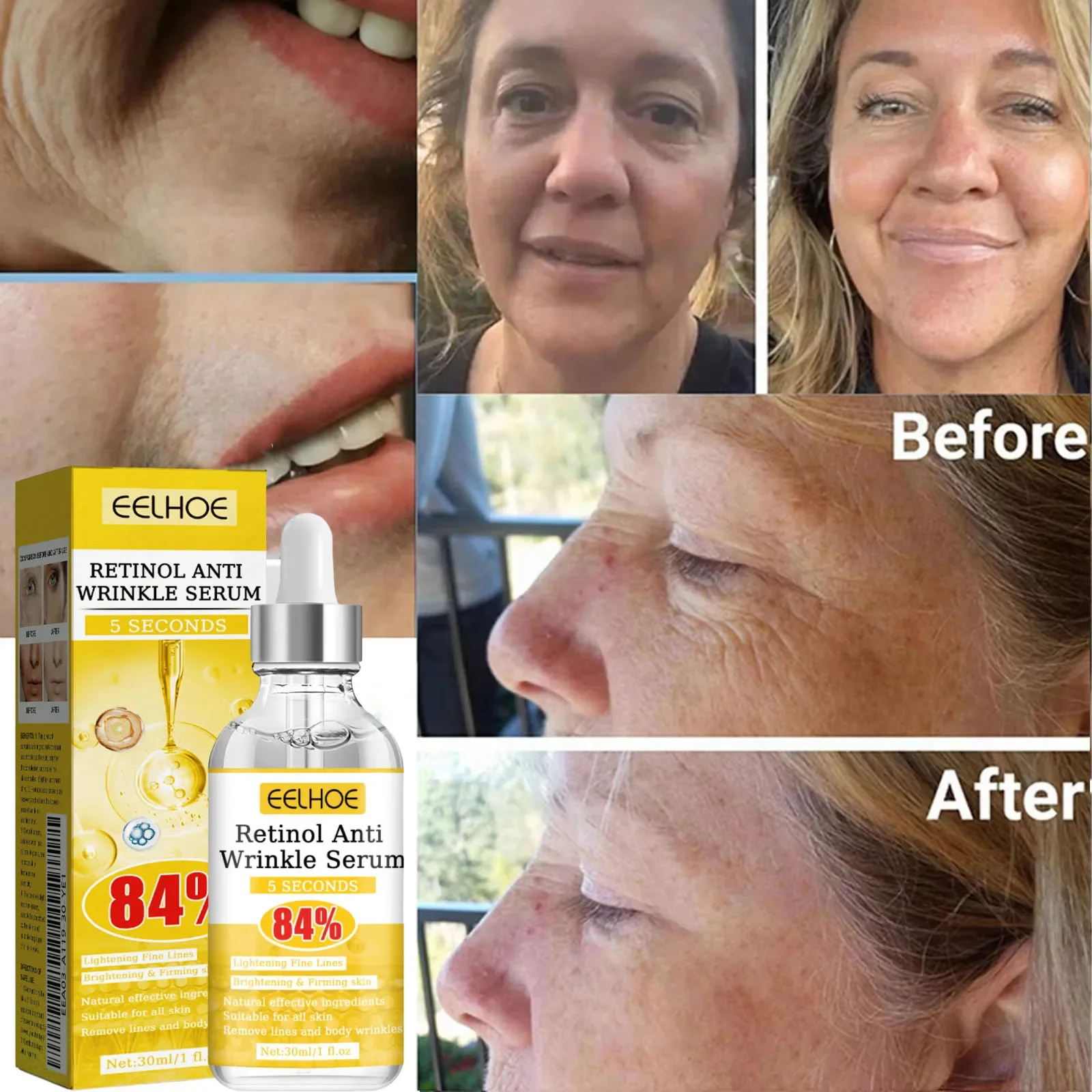 Instant Wrinkle Remover Face Serum Anti-Aging Lifting Firming Fade Fine Lines ปรับปรุงผิวหมองคล้ําชุ่มชื่นเครื่องสําอางเกาหลี