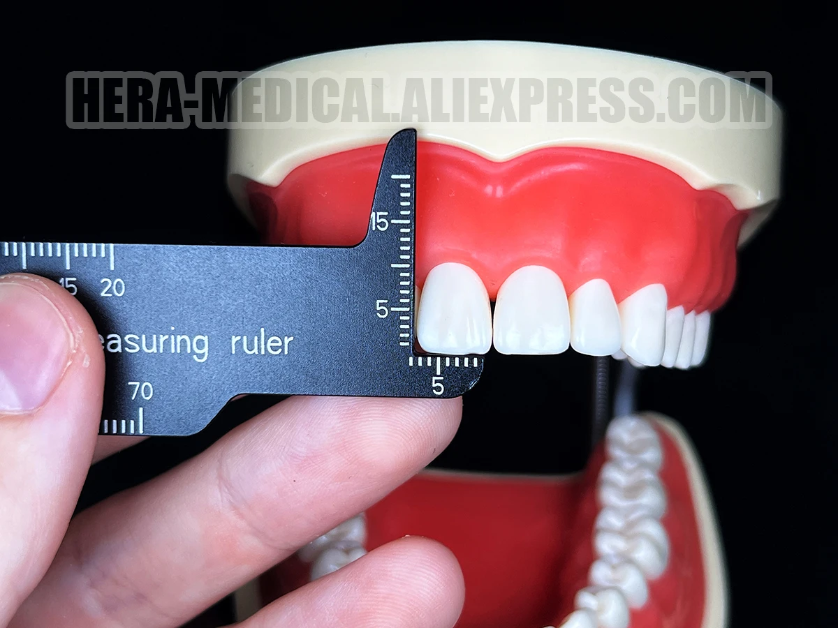 Calibro Dentale Iwanson Pinza Calibro Dentale Medentra In Acciaio - Misuratore Corona Ortodontica, 3 Anni Garanzia Strumenti Ortodontici Garanzia 3 Anni