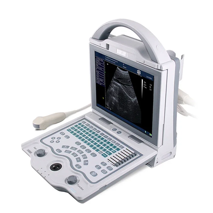 Selling well portable ultrasound YSB5600 high quality digital portable B/W ultrasound machine