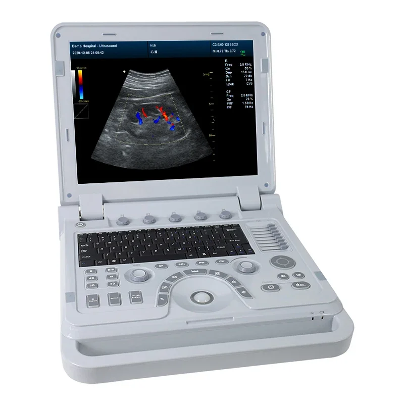 CONTEC CMS1700B 4D Color Doppler USG Color Cardiac Ultrasound Scanner Diagnostic Machine Systems Micro Convex Probe