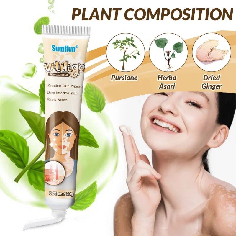 Vitiligo Cream Reduce White Spots Melanin Deposits Repair Skin Leukoplakia Disease Relieve Skin Itch Herbal Ointment Care 20g