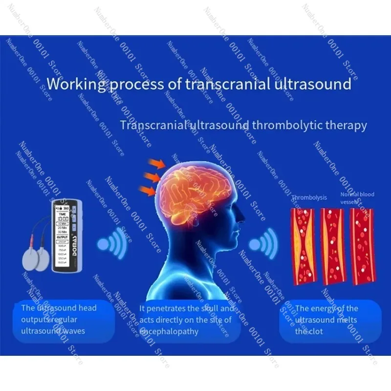 Electric Head Massager, Portable Scalp Stimulator for Relaxation, Cordless Tension Relief Massage Device image 5