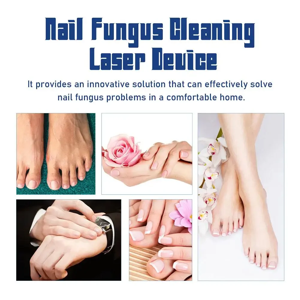 Appareil laser fongique pour ongles, champignon des ongles, machine de traitement au laser, réparation des ongles avec onychomycose, pièces plus lentes, traitement au laser des doigts