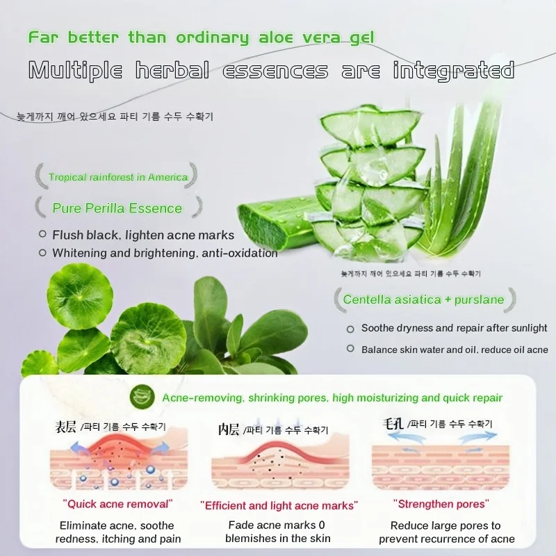 99% Fresh Extract Aloe Vera Solution Moisturizing and Repair Gel Cream Soothes Dry and Sensitive Redness Perilla Aloe Gel 120ml