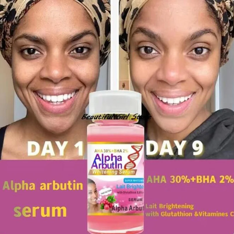 Soro alfa arbutina 120ml aha 30% + bha 2% mantém o rosto suave brilho hidratante melhorar o embotamento creme de beleza da pele escura