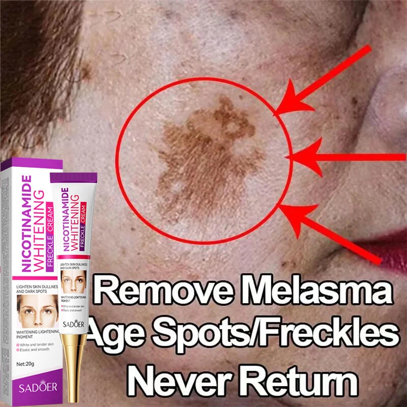 Whitening Freckles Serum Cream Remove Dark Spots Melasma Niacinamide Lighten Melanin Anti-aging Moisturizing Brighten Skin Care