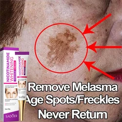 Wybielający krem z serum na piegi usuń ciemne plamy Melasma niacynamid rozjaśniający melaninę Anti-aging nawilżający rozjaśniający pielęgnacja skóry