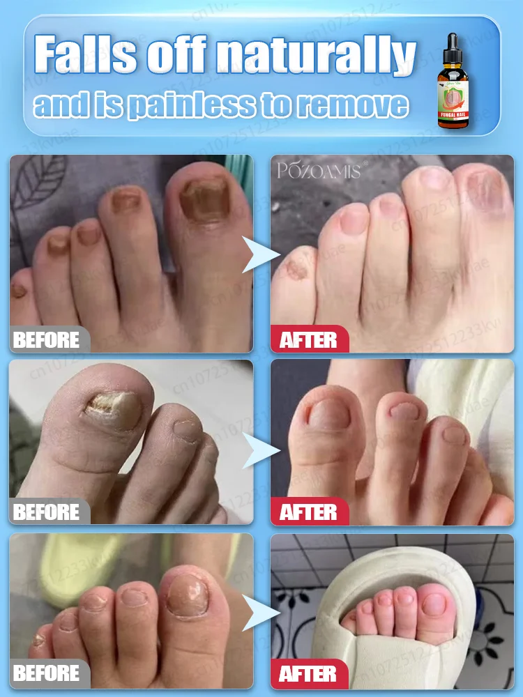 7일 만에 완고한 곰팡이 제거