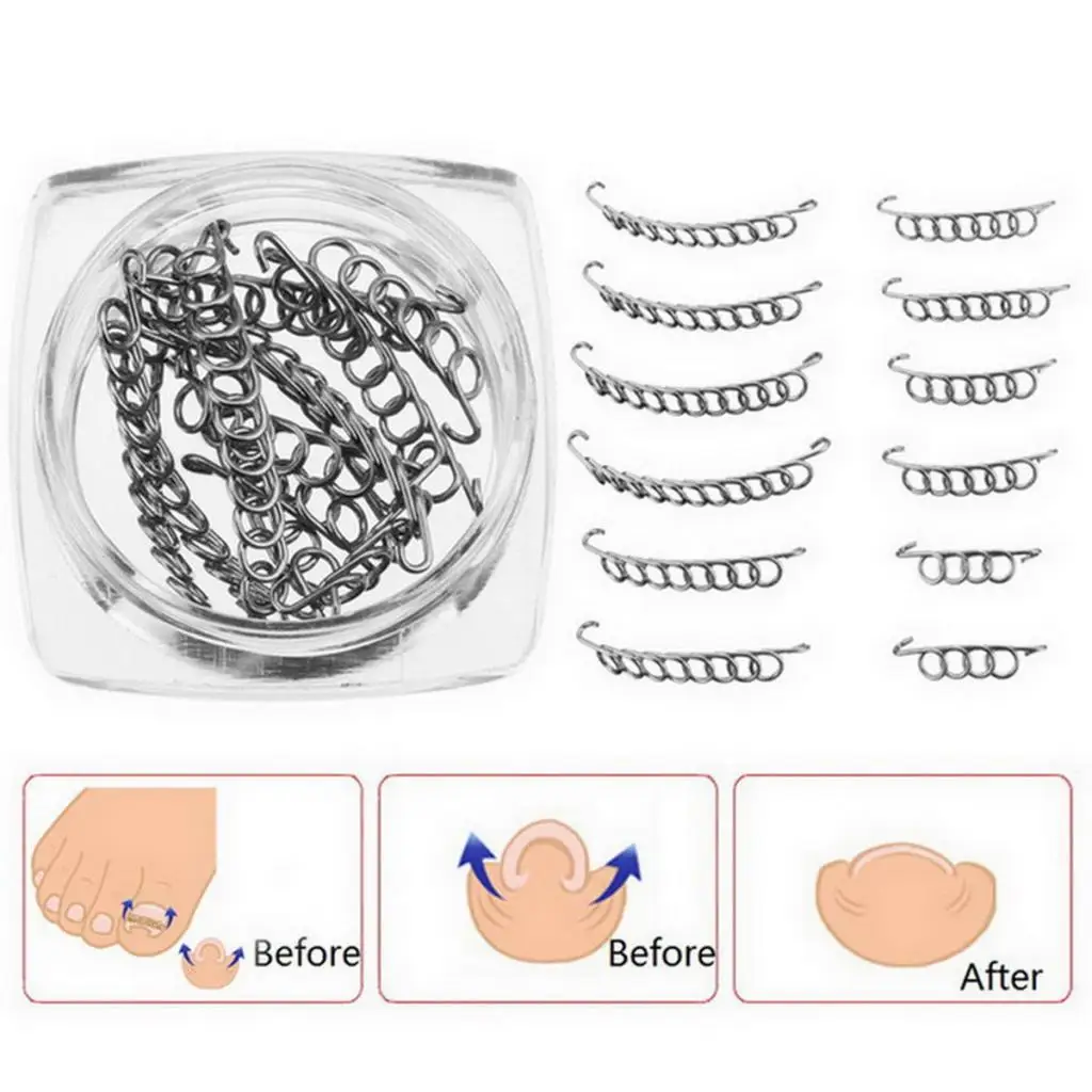 Herramienta de Ucus Pedicura de Alambre